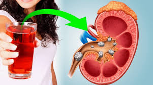 Toxic foods, dirty water, fake drinks: Hidden triggers of kidney failure