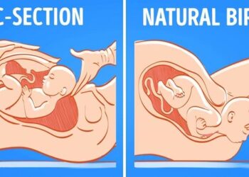 Beyond ‘harvested babies’: Why women fear Caesarean Section